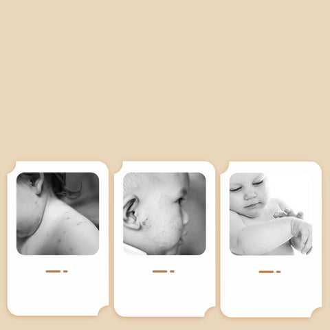 Food-grade Cleaning Solution for Baby Feeder and Fruits